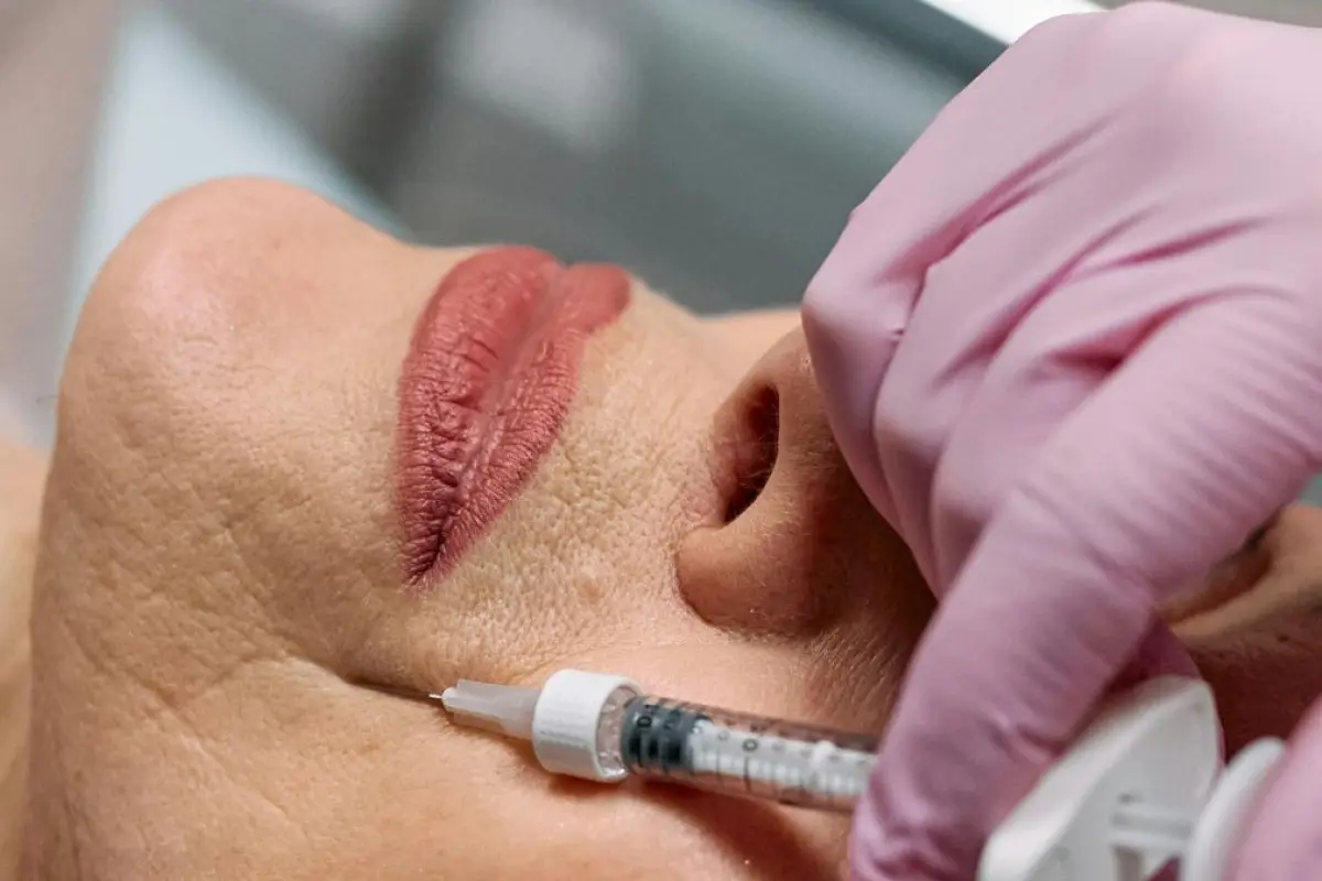 Sculptra, el bioestimulador de colágeno viral que no está permitido en Ecuador y no tiene registro sanitario. (Pexels).