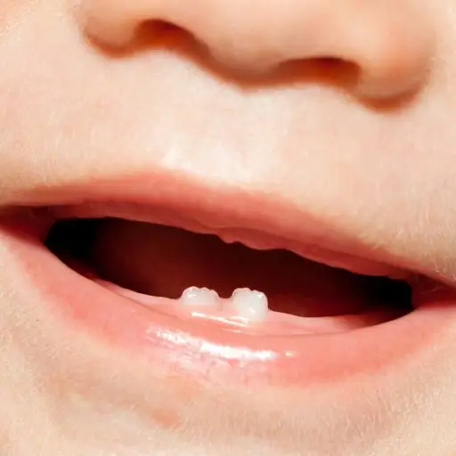 Cómo mantener sanos los dientes de leche de tu bebé desde los primeros meses
