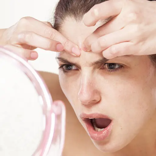 Esto ocurre en tu piel cuando exprimes un grano, según dermatólogos