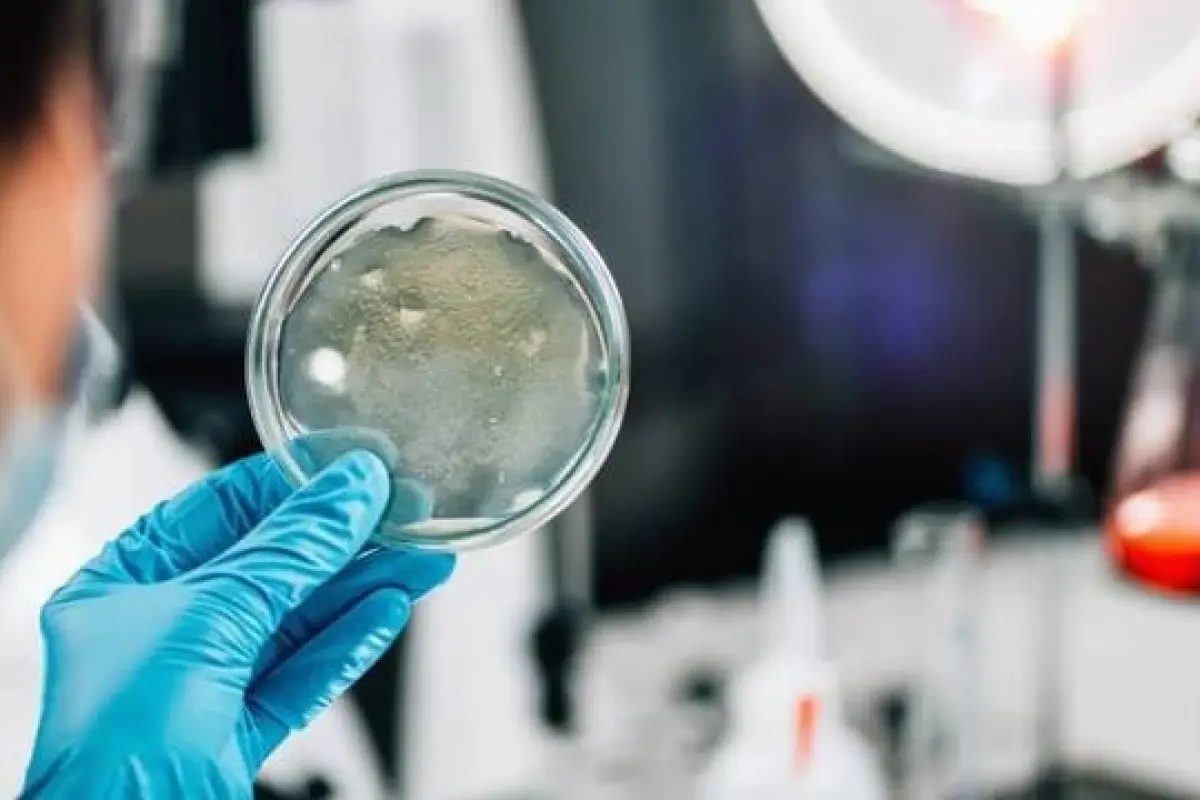 , Te detectaron Salmonella: esto es lo que debes saber hoy mismo