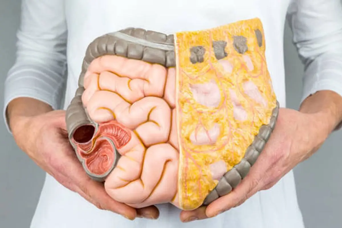 La salud intestinal cumple un rol clave en el equilibrio del sistema inmunológico y en la prevención de la inflamación crónica.
