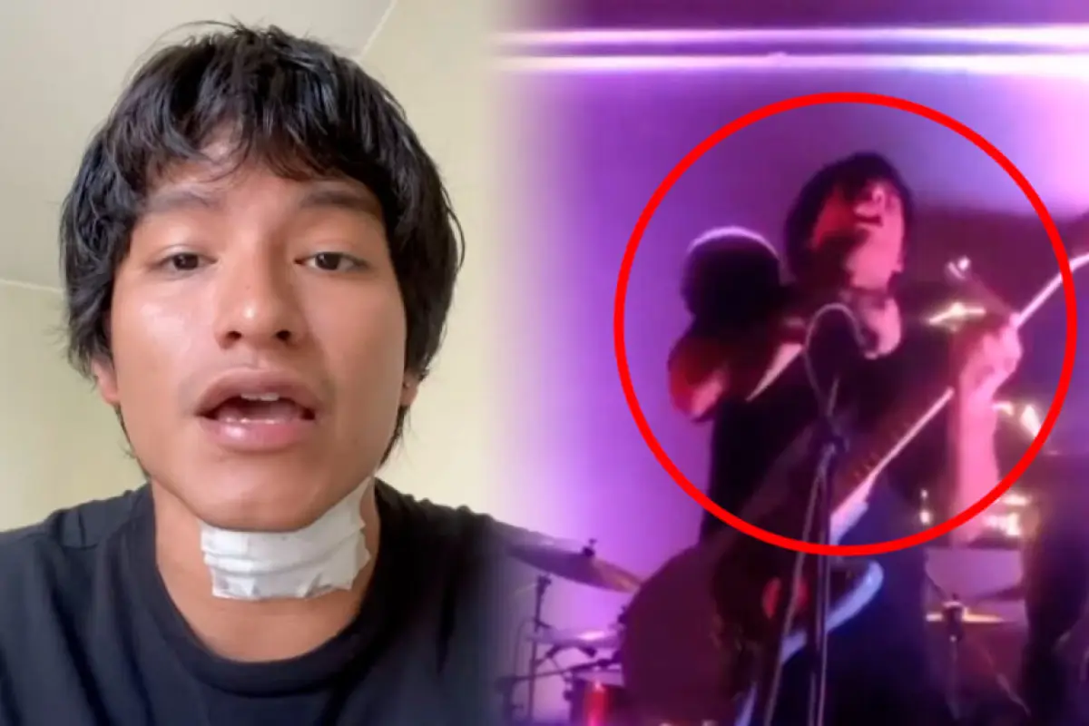 Músico de la banda Mi Mejor Amigo Scott se electrocuta en pleno show en Perú