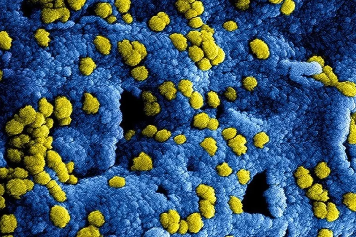 Imagen digital del coronavirus MERS.

REMITIDA / HANDOUT por INSTITUTO NACIONAL ALERGIAS E INFECCIONES EEUU
Fotografía remitida a medios de comunicación exclusivamente para ilustrar la noticia a la que hace referencia la imagen, y citando la procedenci