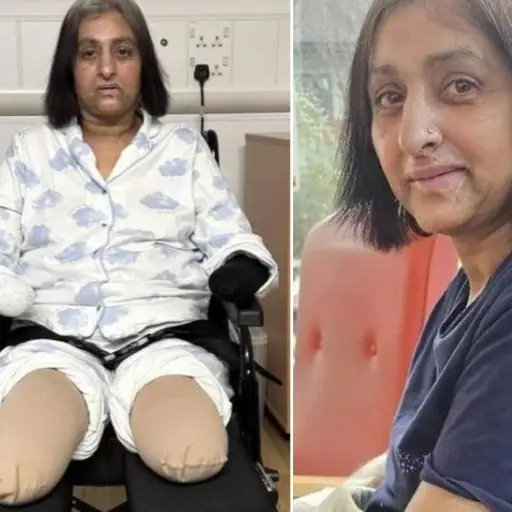 Una mujer perdió sus cuatro extremidades por contraer sepsis tras una lamida de su perro
