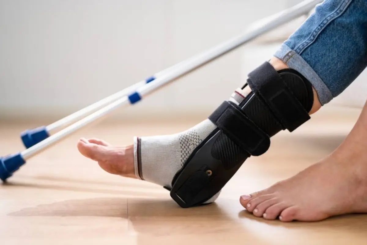 Dejar a medias la rehabilitación de un esguince puede causar lesiones recurrentes., Europa Press.