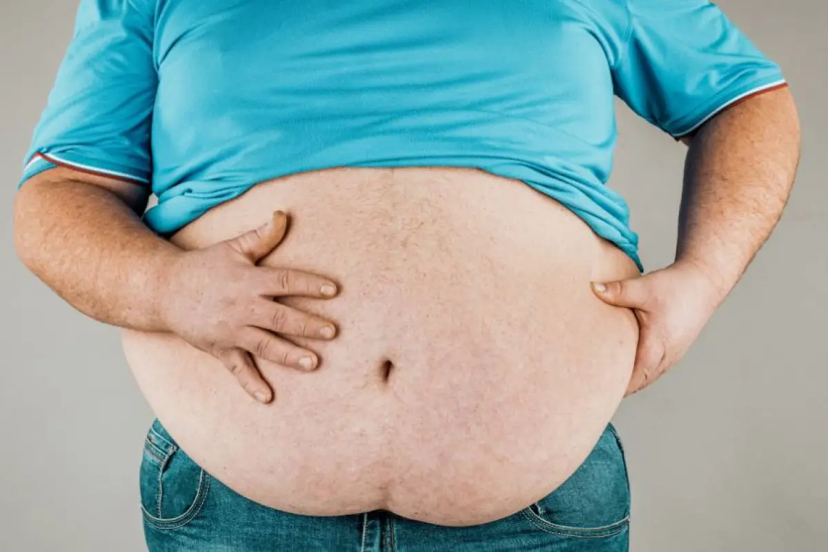 La obesidad es el detonante de múltiples enfermedades crónicas.