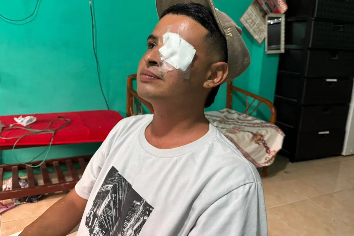 Erick Coello relata secuelas tras ataque en altamar, La Marea