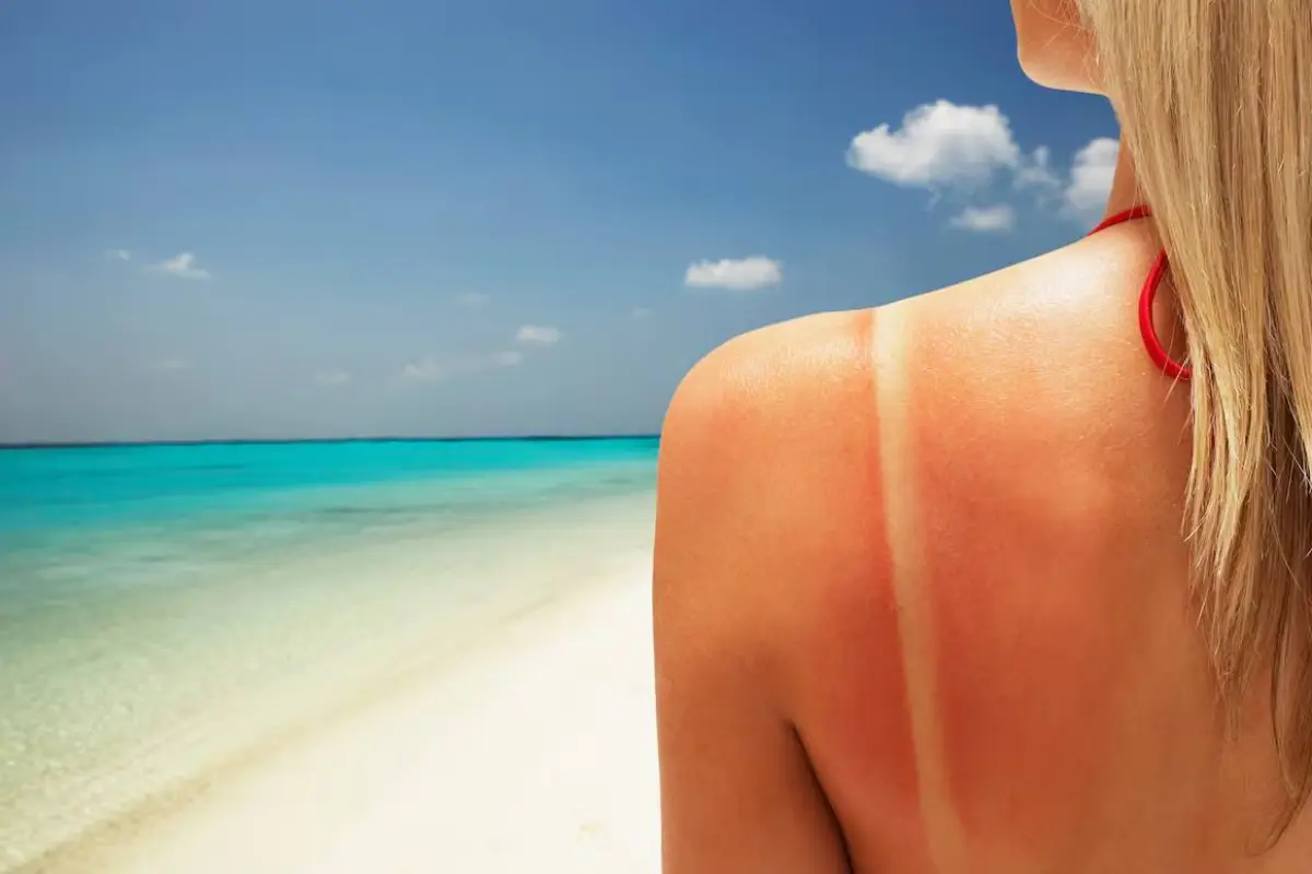 bronceado