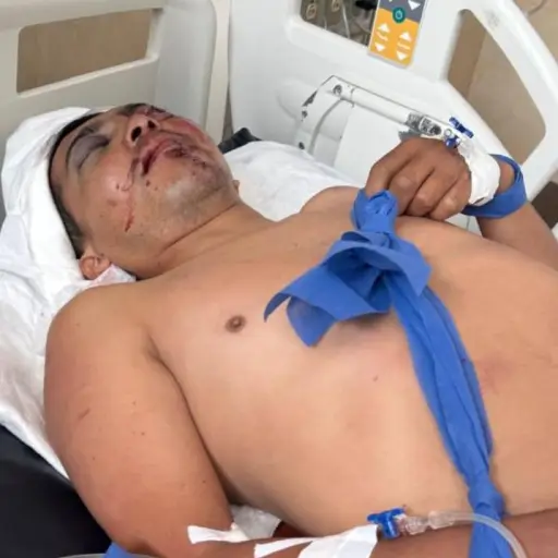 Accidente en Santo Domingo deja a padre de familia grave y su familia pide ayuda urgente