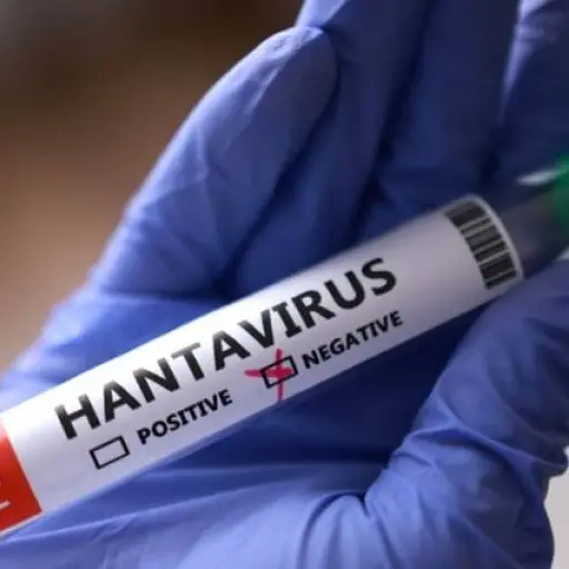 EEUU sigue de cerca más de 40 posibles contagios de hantavirus