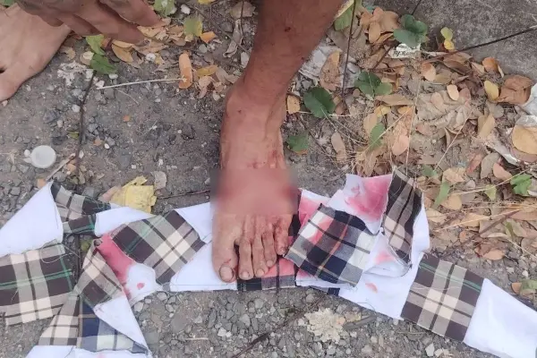 El hombre rescatado tenía cortes e sus pies. 