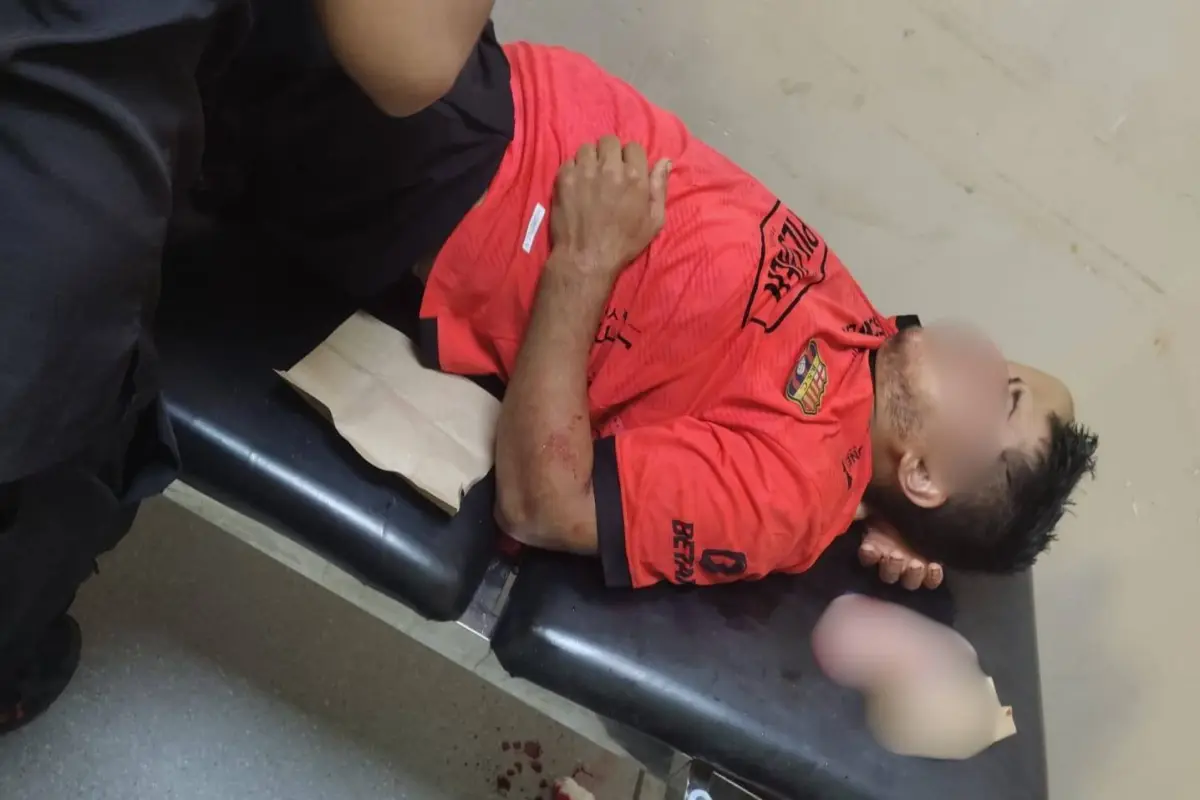 El herido tenía seria lesiones en su rostro, por lo que fue atendido de emergencia., Cortesía
