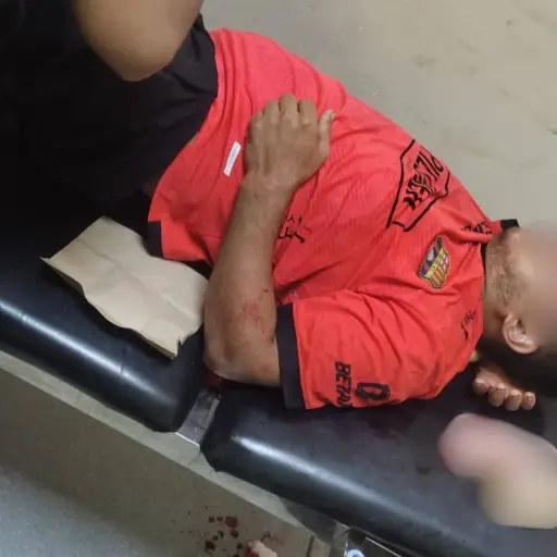 Motociclista sufre graves lesiones tras accidente en El Carmen