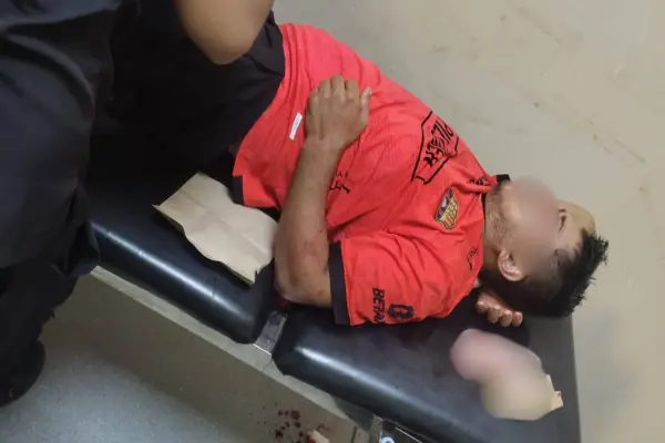 El herido tenía seria lesiones en su rostro, por lo que fue atendido de emergencia. ,Cortesía