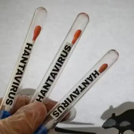 Tres muertes confirmadas y dos casos bajo investigación: el panorama del Hantavirus en Venezuela
